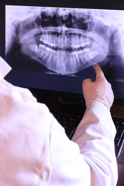 Best Emergency Treatment for Dental Infections or Abscesses in Carbon Cliff, IL