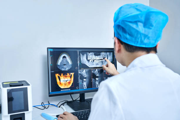 Best Emergency Wisdom Teeth Removal in Carbon Cliff, IL