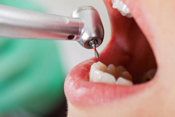 Best Weekend Emergency Dentist in Carbon Cliff, IL